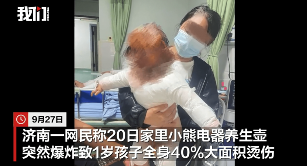 开源策略 养生壶爆炸1岁孩童全身40%烫伤 品牌客服：正在全力核查